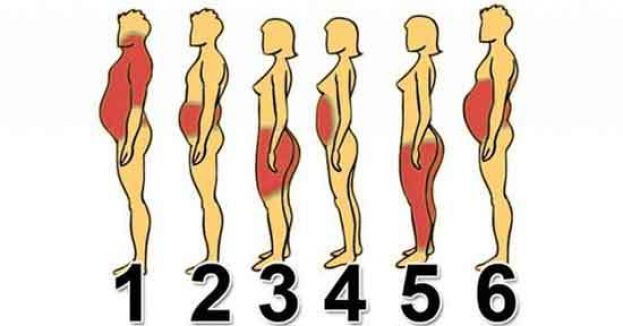 DOVE INGRASSI DI PIU'?DI QUALE OBESITA' SOFFRI?ECCO 6 TIPI DI SOVRAPPESO E LE SOLUZIONI PER LIBERARTENE