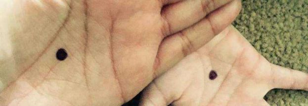 UN PUNTINO NERO SUL PALMO DELLA MANO,LE FOTO INVADONO I SOCIAL:ECCO IL MOTIVO