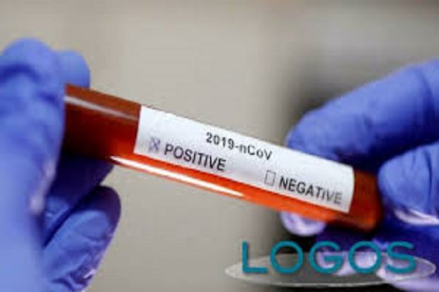 Tampone coronavirus