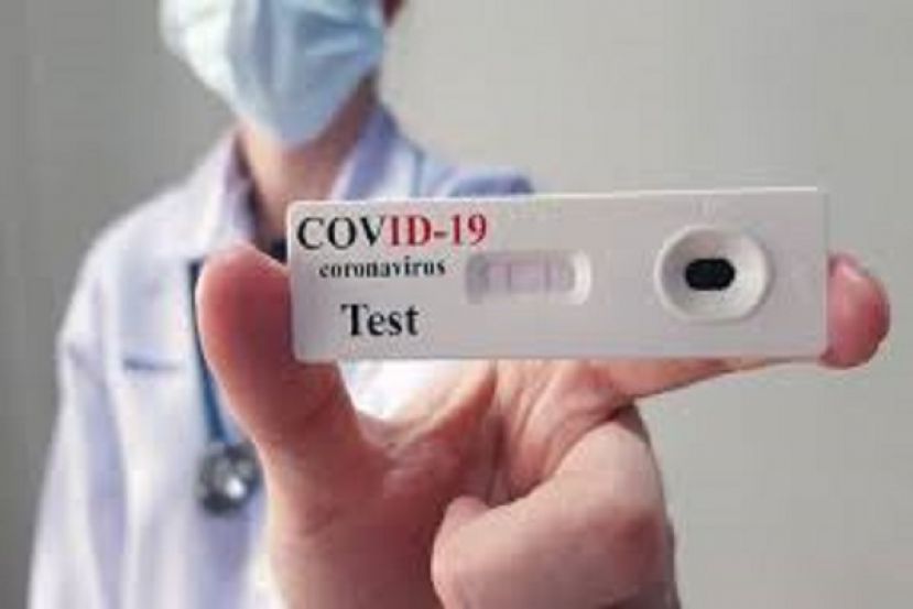 Coronavirus-Test