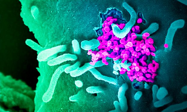 Coronavirus