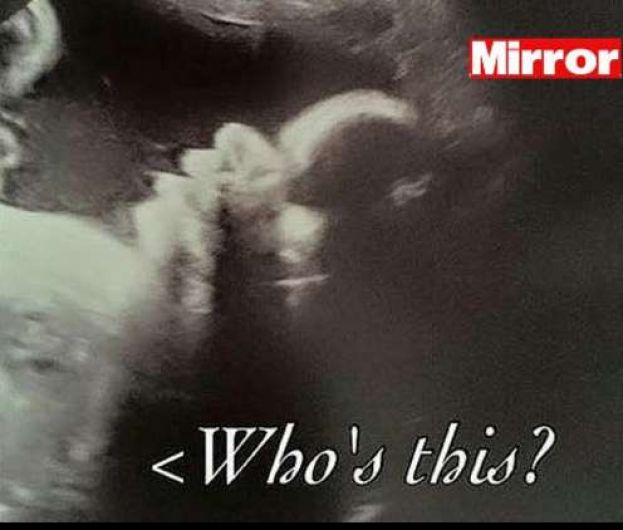MAMMA IN DOLCE ATTESA FA UN'ECOGRAFIA DI CONTROLLO E VEDE QUALCOSA DI INQUIETANTE