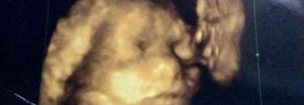 IL NONNO DEFUNTO BACIA LA NIPOTINA NEL GREMBO DELLA MAMMA.L'ECOGRAFIA CHE EMOZIONA