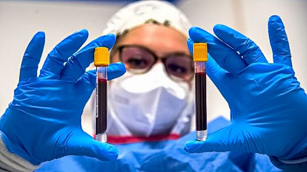 Covid-19,Test Sierologico