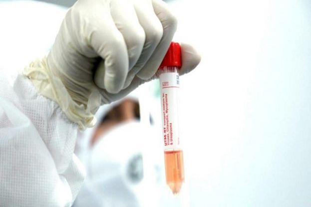 Test Coronavirus